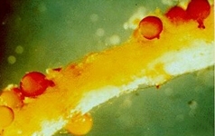 Golden nematode cysts on plant root