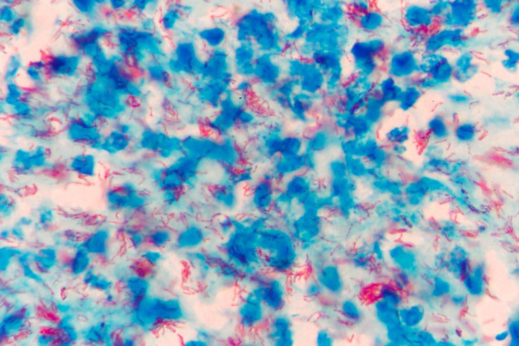 Mycobacterium tuberculosis under microscope